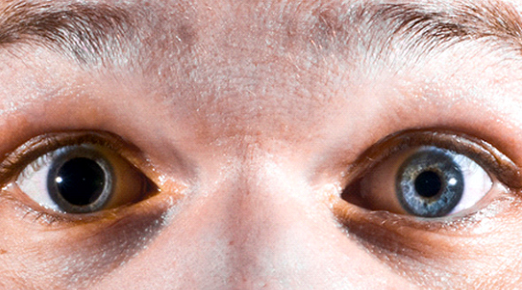 Pupil Dilation, Age, visual acuity and Eye Colour