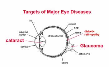 How dangerous of an eye disease is glaucoma?